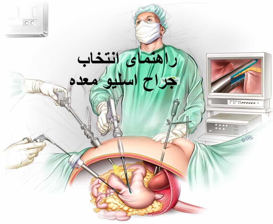 راهنمای انتخاب جراح اسلیو معده