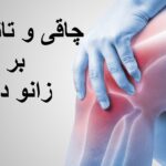 چاقی و تاثیر آن بر زانو درد